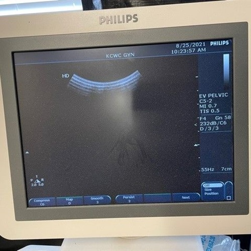 Philips HD7 Ultrasound